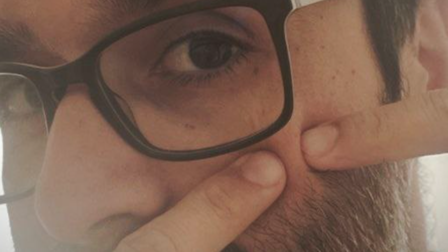 El periodista Andrés Cardenete se quita un grano